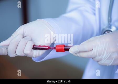 Dimostrazione di uno strumento per l'analisi del sangue in una provetta sottovuoto in vetro per individuare il valore di ossigeno nel sangue Foto Stock