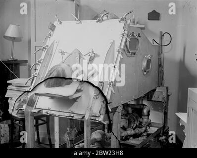 'Iron lung' salva la vita del ragazzo a Guys. Macchina meravigliosa che respira per il paziente. Il 'polmone di ferro', il meraviglioso apparato medico che respira per il paziente, è stato utilizzato al Guys Hospital di Londra, per salvare la vita di un ragazzo i cui muscoli polmonari avevano smesso di funzionare durante una grave malattia. I medici hanno fatto un volo di notte e di giorno per la vita dei ragazzi, e con l'aiuto del 'polmone di ferro' ha vinto la loro battaglia. Il 'polmone di ferro', che costa Â£300, viene utilizzato quando i muscoli polmonari del paziente non possono funzionare, a causa di una rottura o paralisi dei muscoli. Il paziente viene posto nel polmone che prende ov Foto Stock