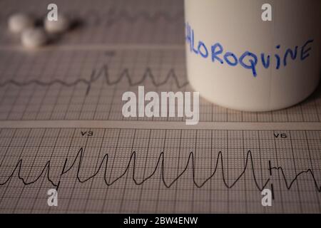 Effetti avversi sul cuore da parte di idrossiclorochina o clorochina. Pillole su un elettrocardiogramma con aritmie cardiache. Contenitore bianco con 'idro Foto Stock