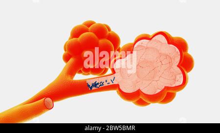 illustrazione 3d alveoli nel contesto del rilascio di virus e batteri Foto Stock