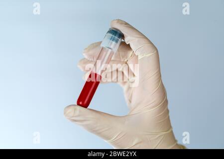 Provetta con un campione di sangue nelle mani di un infermiere. Analisi del sangue per i virus in clinica con l'osservanza di precauzioni. Foto Stock