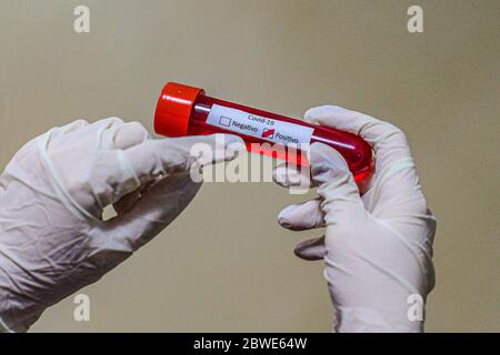 Florianópolis - SC, 29/05/2020 - testes de sangue do COVID-19.. Foto: Eduardo Valente/iShoot (Foto: Eduardo Valente/iShoot/Alamy (carica con legenda e Foto Stock