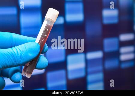 Analisi di laboratorio di un campione biologico. Una mano con guanti contiene una provetta. Foto Stock