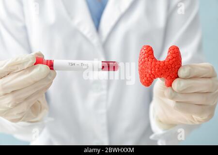 Medico con modello di ghiandola tiroidea e campione di sangue in provetta, closeup Foto Stock