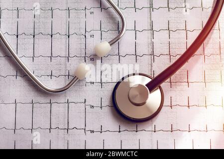 Stetoscopio medico e risultati ecg sotto forma di grafico. Condizione cardiaca nella grafica. Foto Stock