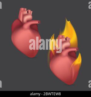 Cuore anatomico in fiamme. Organo umano realistico del sistema interno di circolazione del sangue in fiamma. Illustrazione vettoriale Illustrazione Vettoriale