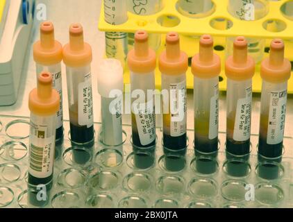 Lipsia, Germania. 20 Maggio 2020. Nel laboratorio medico centrale della St. Georg Clinic di Lipsia, l'assistente di studio per gli studi clinici Laura Winkler lavora su provette per siero con campioni di sangue provenienti da pazienti. I campioni di siero per la determinazione degli anticorpi dei virus corona vengono conservati in congelatori per ulteriori studi. Credit: Waltraud Gruchitzsch/dpa-Zentralbild/ZB/dpa/Alamy Live News Foto Stock