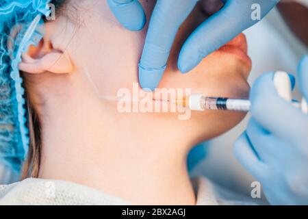 Mandibloplastia non chirurgica - gli angoli della mandibola - procedura per l'introduzione del principio attivo - sotto la pelle, in ar pre-marcato Foto Stock