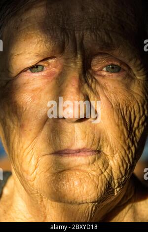 Una donna di 83 anni con una vasta gamma di problemi medici ed emotivi. Foto Stock