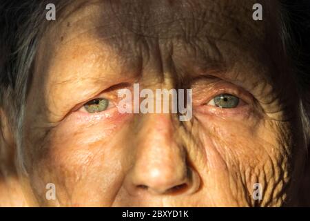 Una donna di 83 anni con una vasta gamma di problemi medici ed emotivi. Foto Stock