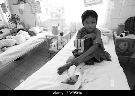 Ospedale di emergenza, Battambang, Cambogia, Asia, effetti delle mine Foto Stock