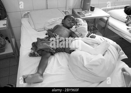 Ospedale di emergenza, Battambang, Cambogia, Asia, effetti delle mine Foto Stock