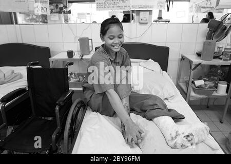 Ospedale di emergenza, Battambang, Cambogia, Asia, effetti delle mine Foto Stock