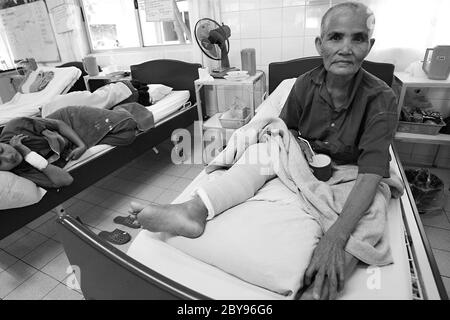 Ospedale di emergenza, Battambang, Cambogia, Asia, effetti delle mine Foto Stock