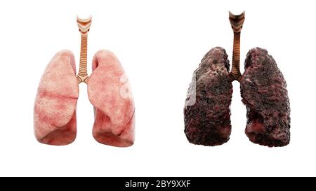 polmoni sani e polmoni affetti da malattia su isolato bianco. Concetto medico autopsia. Cancro e problema di fumo. rendering 3d Foto Stock