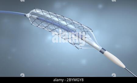 3d illustrazione di un impianto di stent per sostenere la circolazione del sangue nei vasi sanguigni Foto Stock