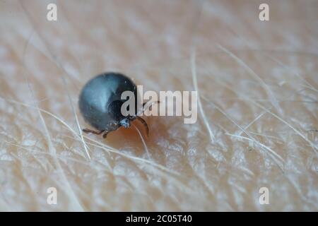 Super close up macro di sangue riempito nero grigio scuro tick maschio colorato (Ixodes ricinus) strisciando sulla pelle umana. Foto Stock