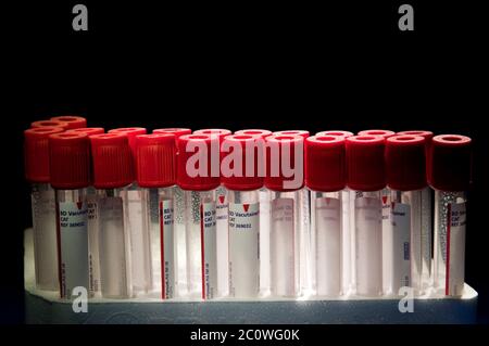 Linee, test, parallelamente, tubi posti, ombreggiato, a due, vetro, calice, tumbler, Foto Stock