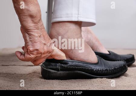 Donna anziana gonfia piedi mettendo su scarpe Foto Stock