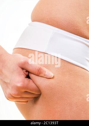 Close up donna cellulite controllo sulle sue natiche Foto Stock