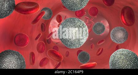 3d illustrazione del forte aumento del bianco non funzionale le cellule del sangue chiamate cellule leucemiche che conduce al sangue malattia del cancro Foto Stock