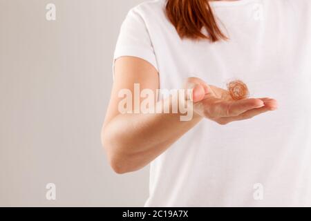 Donna perdita di capelli. Foto Stock