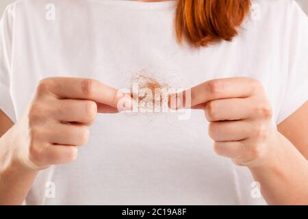 Donna perdita di capelli. Foto Stock