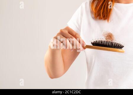 Donna perdita di capelli. Foto Stock