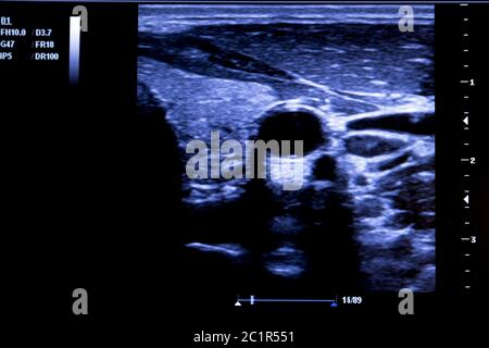 Immagine colorata dei moderni monitor ad ultrasuoni Foto Stock