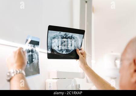 Il dentista esamina due raggi X della bocca di un paziente Foto Stock