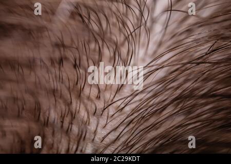 Macro Shot di assottigliamento dei capelli sulla testa Foto Stock