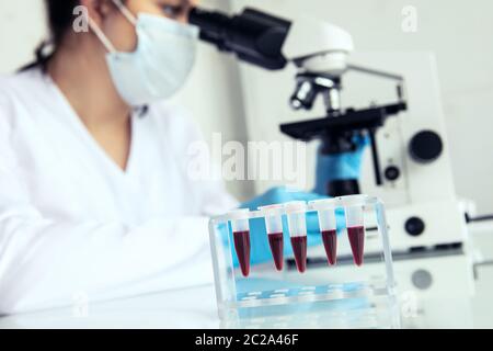 Provette Eppendorf con sangue da esaminare. Le provette Eppendorf con sangue e medico femminile esaminano i campioni al microscopio Foto Stock