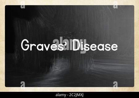 malattia di Graves Foto Stock