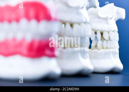 Ganasce umane con modelli anatomici di denti e gengive Foto Stock