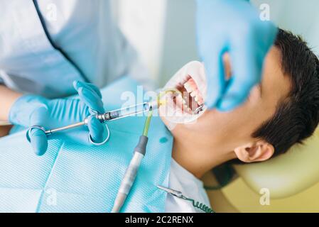 Guarnizione di tenuta del processo di installazione, odontoiatria pediatrica, bambini stomatologia. Dentista femmina funziona con little boy in clinica dentale Foto Stock