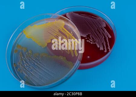 Capsule di Petri con colonie batteriche su sfondo blu. Primo piano Foto Stock