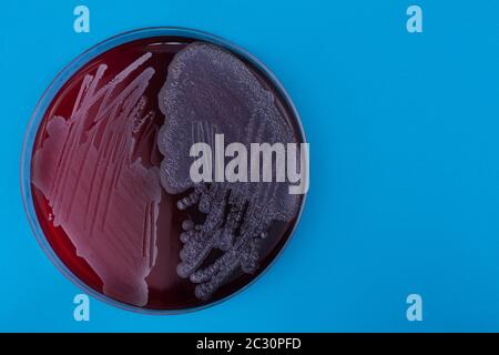 Capsula di Petri con batteri su sfondo blu. Batteri Staphylococcus aureus e pseudomonas aeruginosa su piastra di agar Foto Stock