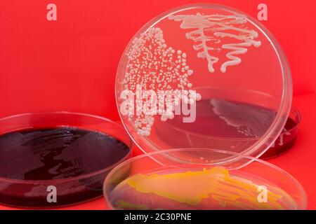 Capsula di Petri con batteri su sfondo rosso. Batteri Candida albicans su piastra di agar Foto Stock