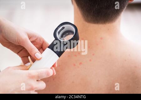 Close-up di persona le mani esaminando l'Acne pelle dell uomo con Dermatoscope Foto Stock