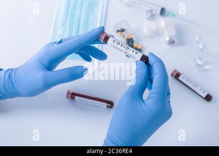 Analyst Hands con guanti protettivi che tengono il sangue di prova per Coronavirus COVID 19. Test antivirus e concetto di ricerca Foto Stock