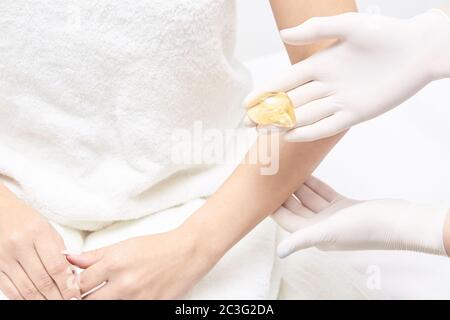 Epilazione indesiderata con cera per capelli. Giovane Donna. Procedura di trattamento del salone di cosmetologia. Ceretta domestica Foto Stock