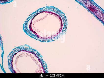 Pastori Purse, Campsella, embrioni, vista al microscopio Foto Stock