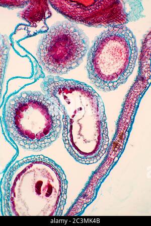 Pastori Purse, Campsella, embrioni, vista al microscopio Foto Stock