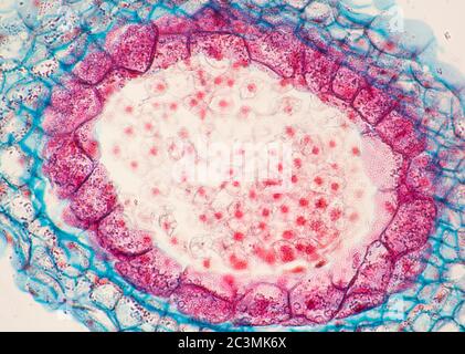 Pastori Purse, Campsella, embrioni, vista al microscopio Foto Stock