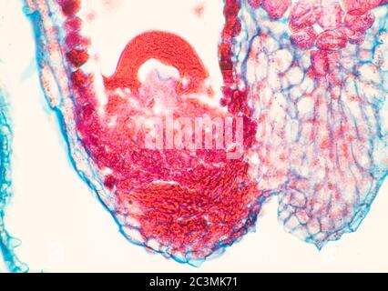 Pastori Purse, Campsella, embrioni, vista al microscopio Foto Stock