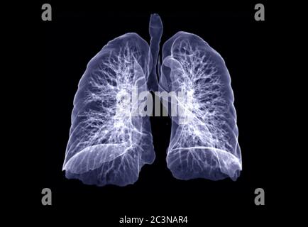 Immagine di rendering TC torace o polmone 3D visualizzata sullo schermo per la diagnosi TB, tubercolosi e covid-19 . Foto Stock