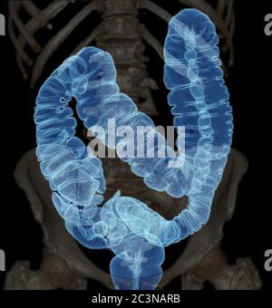 Colonografia TC o scansione TC dell'immagine di rappresentazione 3D del colon Vista AP che mostra il colon per lo screening del cancro colorettale. Check up Screening Colon Cancer. Foto Stock