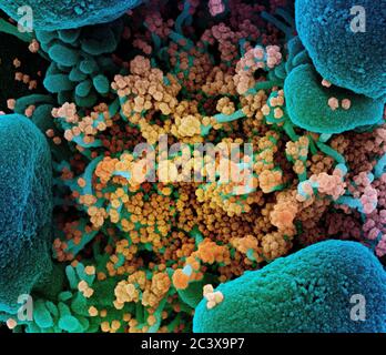 Novel Coronavirus SARS-COV-2 micrografia elettronica a scansione colored di una cellula apoptotica (blu) fortemente infettata con particelle di virus SARS-COV-2 (giallo), isolata da un campione di paziente. Immagine catturata presso il NIAID Integrated Research Facility (IRF) di Fort Detrick, Maryland. Foto Stock