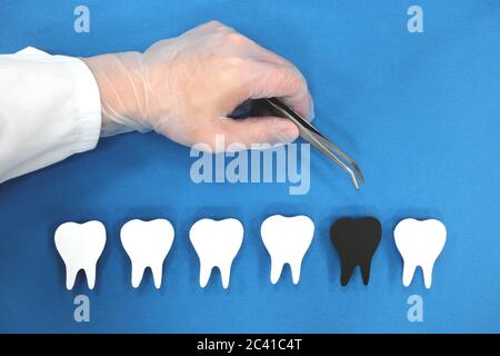Decadimento dei denti e concetto di assistenza sanitaria dentale. Mano dentista con pinzette che tira i denti neri. Foto Stock
