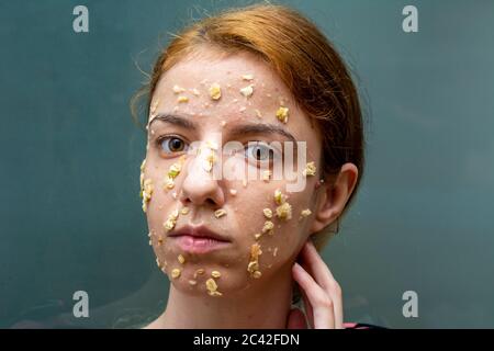 Farinata d'avena fai da te con miele, yogurt e maschera di mela per l'acnee e l'idratazione della pelle Foto Stock